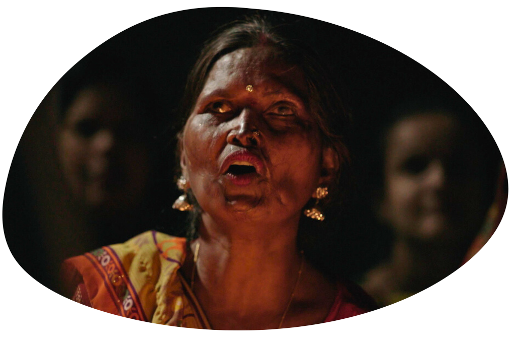 A photo of an Indian woman with a scarred face from the documentary Geeta.